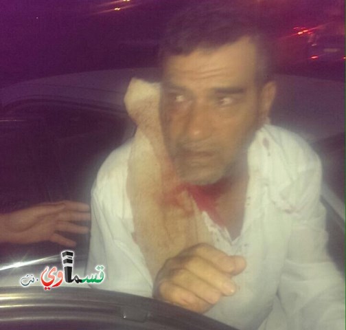 الشرطة: اعتقال عرب بشبهة الاعتداء على أبو شرخ والخلفية جنائية - العائلة: هذا تضليل